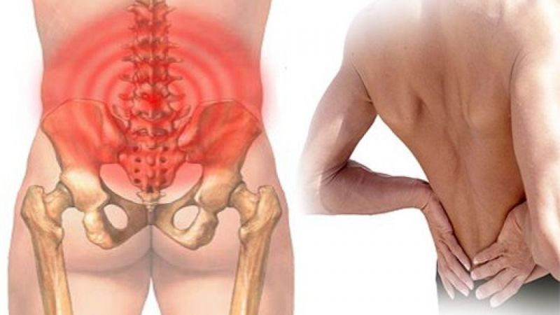 Phục hồi chức năng đau thắt lưng